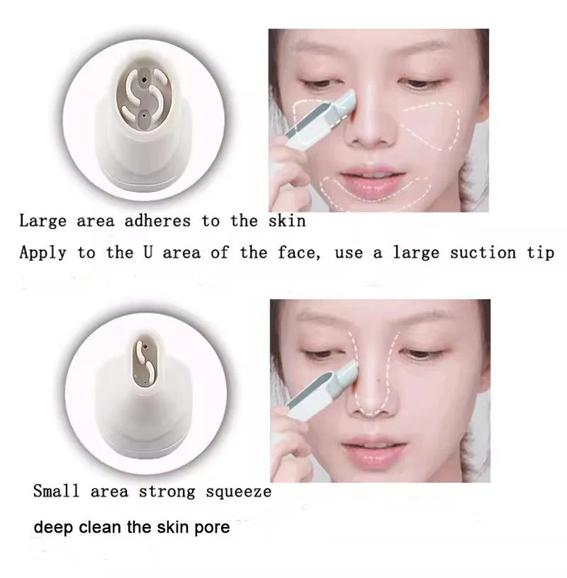 Hydra Dermabrasion Aqua Peeling Facial Beauty Machine Vacuum Blackhead Cleaner White 34x21cm Home Use
