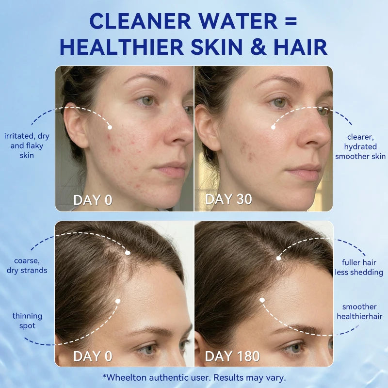 Shower Water Filter Reduces Chlorine Heavy Metal Sediment Bathroom Water Purifier Filter Set Skin Hair Care 17.9 × 6 × 6cm
